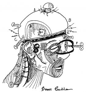 Headache - Pain In the Head