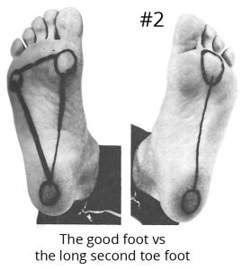 Good Foot vs Long Second Toe Foot
