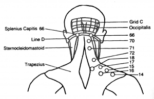 Bonnie Prudden Back of head neck shoulders
