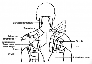 Bonnie Prudden Upper back posterior view