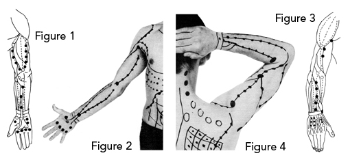 Trigger Points Arm and Hand Both Views