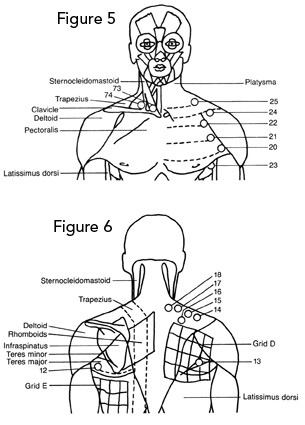 Trigger points torso and upper back