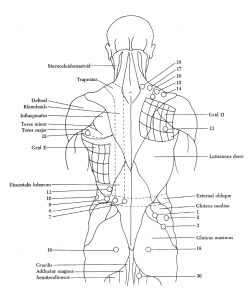 Back Pain Trigger Points