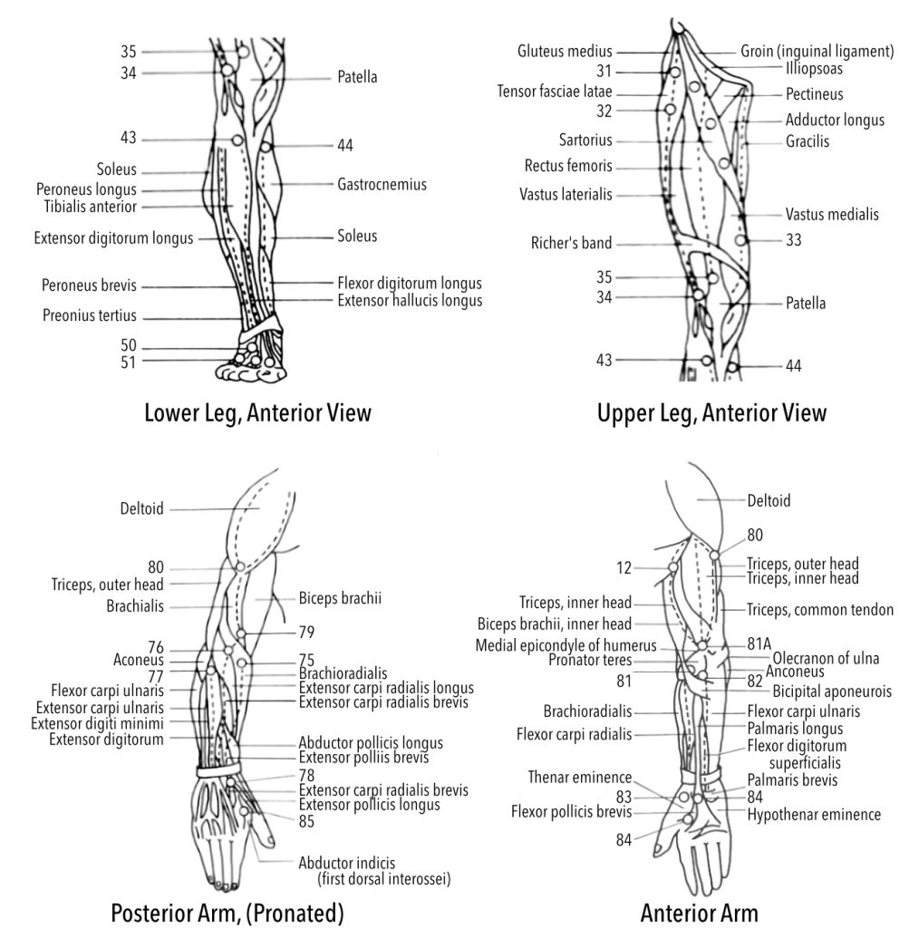 Drawing of legs and arms with trigger points, etc